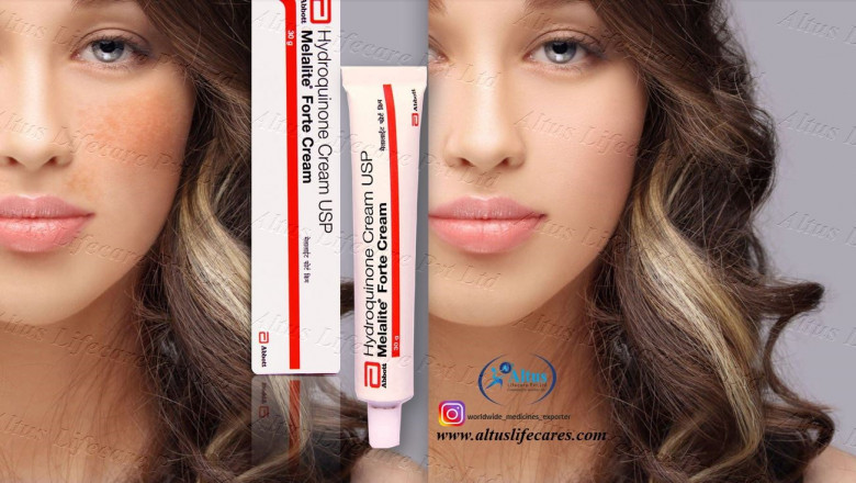 Hydroquinone Cream for Melasma: The Ultimate Secret to Flawless Skin!