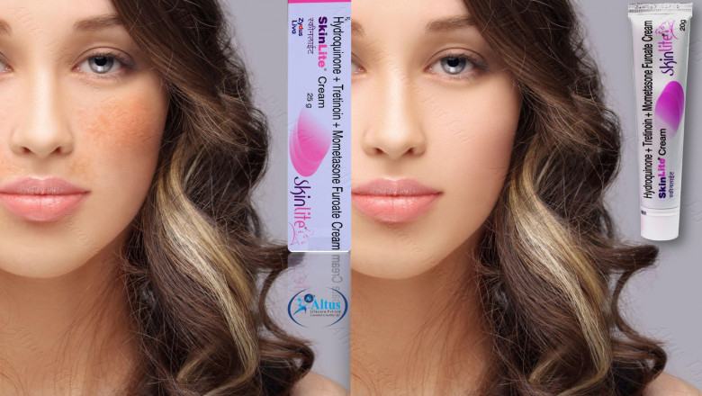 Hyperpigmentation of the Skin: Discover the Secret to Flawless Skin! Say Goodbye to Hyperpigmentation Forever!