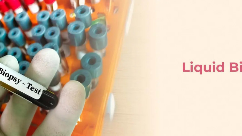 Liquid Biopsy For Cancer Diagnosis: Everything You Need To Know