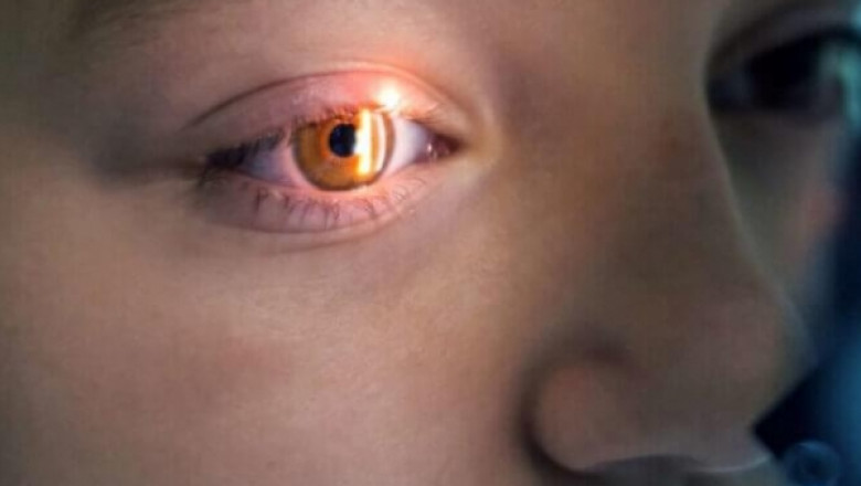 Optic Neuritis Treatment Market Sees Growth From AI Imaging