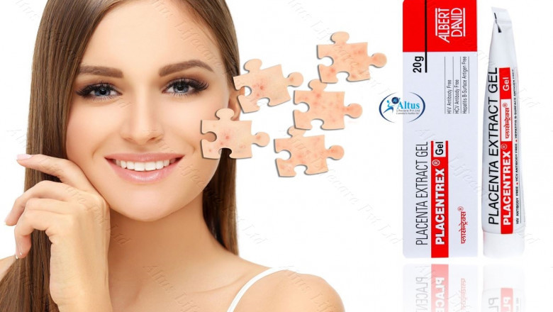 Placentrex Power: Unlock the Key to Flawless Skin Today!