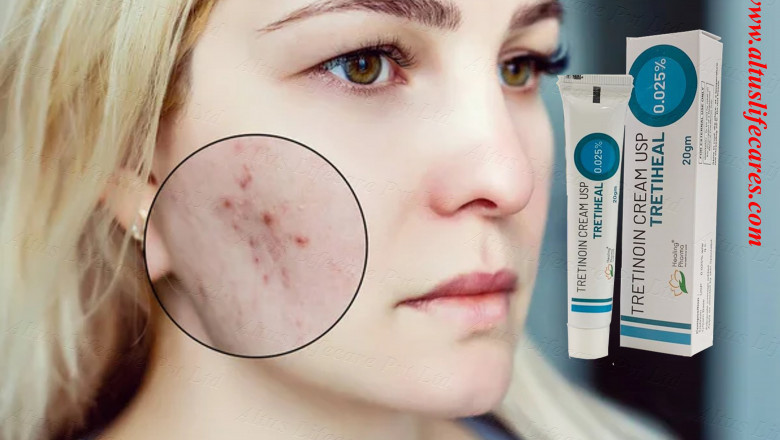 Radiant Skin Awaits with Tretiheal Cream – Discover the Secret to Ageless Beauty!