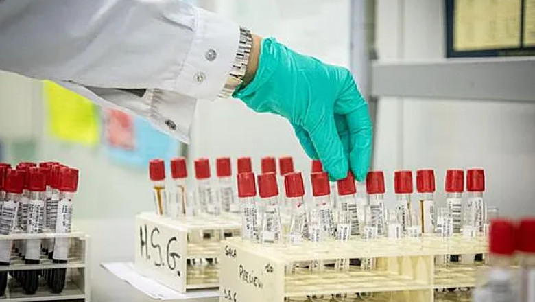Serological Testing Market Report Unveils Growth Momentum and Emerging Trends