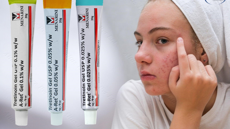 The #1 Acne Treatment They Don't Want You to Know About – Shocking Results!