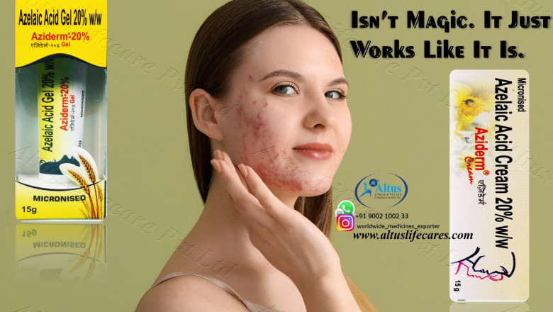The Azelaic Acid Cream Revolution: Witness the Incredible Skin Makeover!