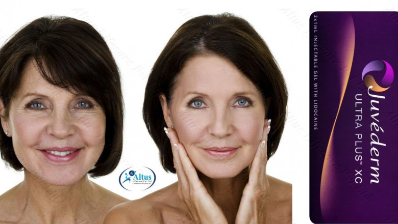 Get the Perfect Pout: Juvederm Ultra Plus XC Lip Enhancement