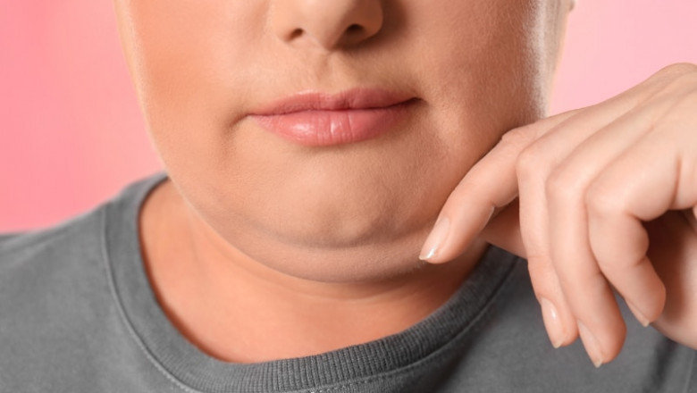 How to Get Double Chin Removal Results Quickly and Safely