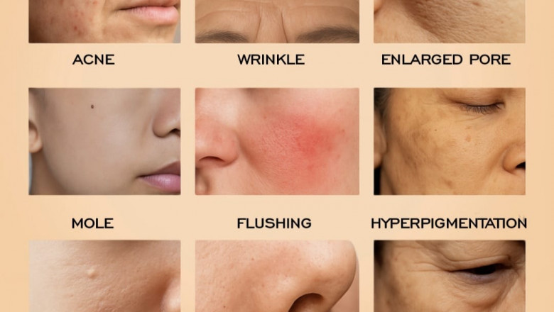Top Skin Clinic in Mogappair | EverGlo Skin, Hair & Laser Clinic