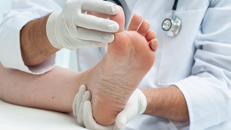 Why Seeing a Podiatrist San Antonio Residents Trust Can Improve Your Foot Health