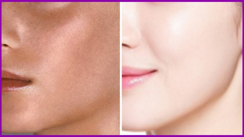 Effective Skin Whitening Solutions for Hyperpigmentation