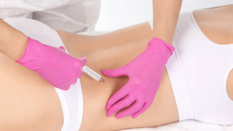 Liposuction in Riyadh: Advanced Technology for Effective Results