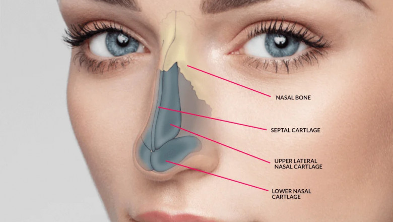 How Much Does Nose Surgery in Dubai Cost? A Complete Guide