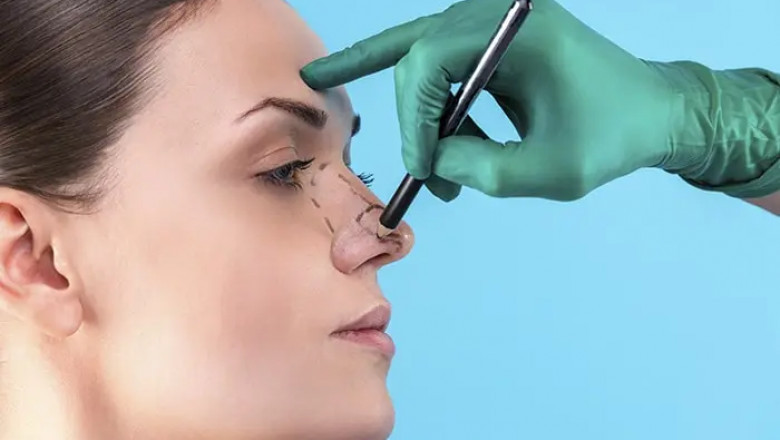جراحة تجميل الأنف