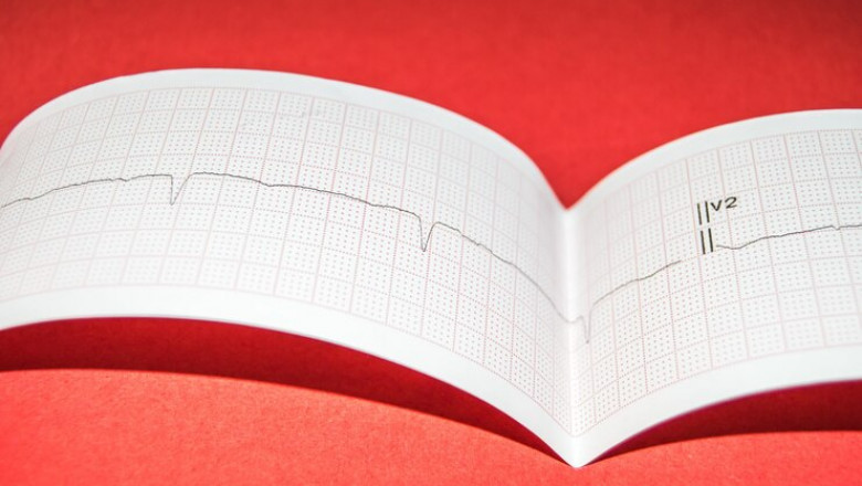 Atrial Fibrillation (Afib) Market Growth and Key Impacting Factors Shaping Industry Trends