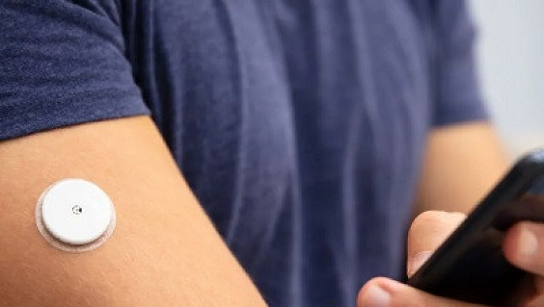United States of America Continuous Glucose Monitoring Market is Anticipated to Witness High Growth Owing to Technological Advancements