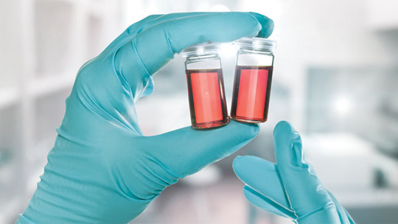 Lab Sample Management & Logistics Market Growth, Size by 2025-2033