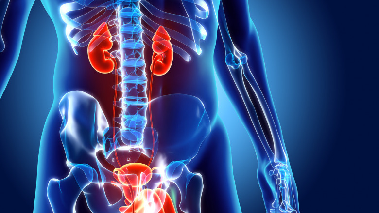 Lupus Nephritis Treatment Market to Surge on Biologic Therapy Advancements