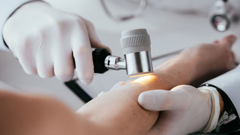 Exploring Opportunities and Overcoming Hurdles in the Dermatology Treatment Devices Market