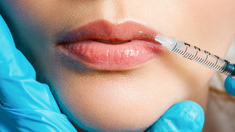 Juvederm Fillers for Youthful, Plump Skin