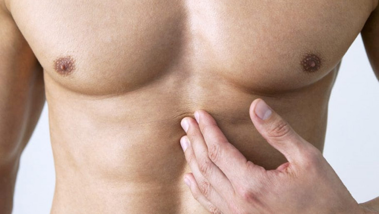 Radiofrequency Treatment: A Modern Approach to Gynecomastia