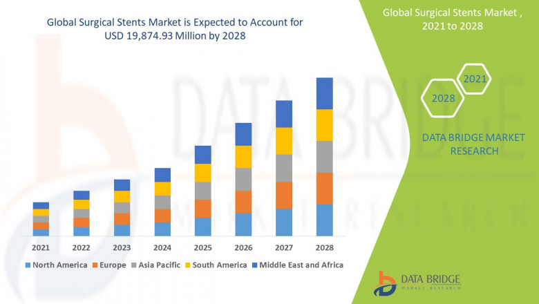 Surgical Stents Market Size, Share, Trends, Key Drivers, Demand and Opportunity Analysis