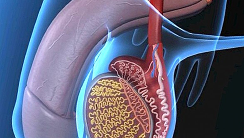 Global Undescended Testicle Market to Surge with Robotic-Assisted Surgery Advances