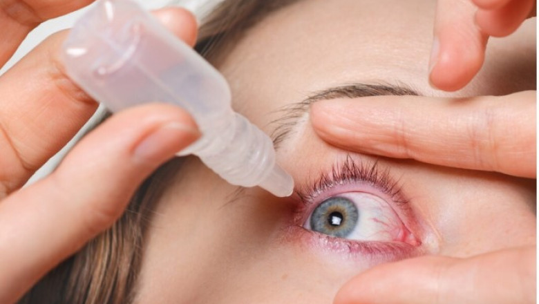 Conjunctivitis Treatment Market Outlook: Innovation in Drug Delivery Systems