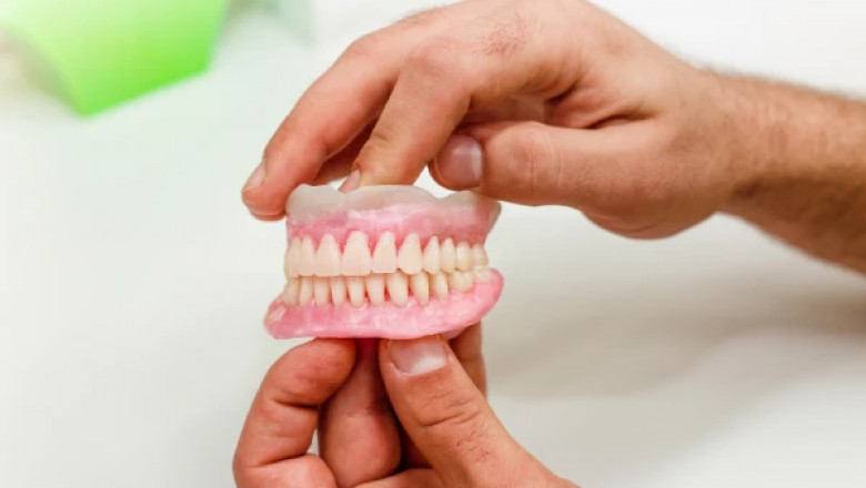 Expert Tooth Extraction in Auckland with Care Dental