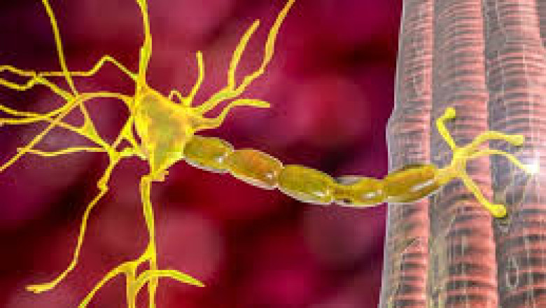 Lambert Eaton Myasthenic Syndrome Market to Witness Growth Owing to Rising R&amp;D