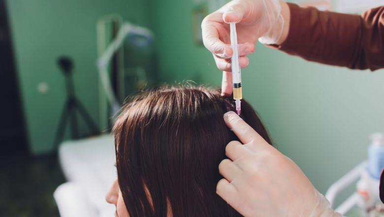 Why PRP Hair Treatments Are a Booming Business in Aesthetics