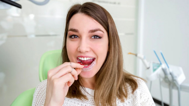 Is Invisalign Braces Treatment Cost Worth It for Mild Cases?