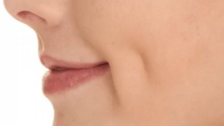 Why Quality Matters More Than Cost in Dimple Surgery