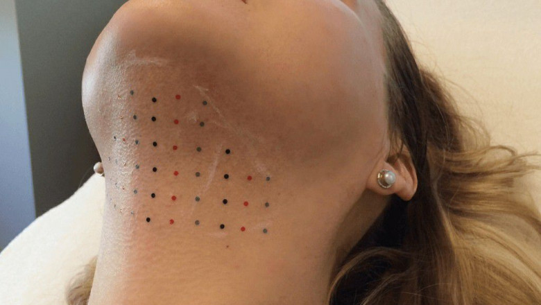 Double Chin Removal for Men and Women Who Want Fast Change