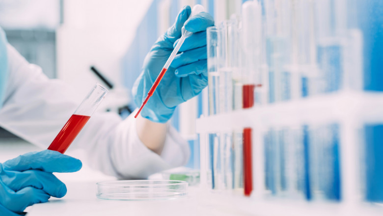 Group Blood Test at Home in Dubai – Ideal for Families