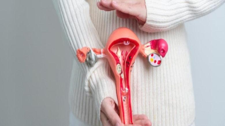 Ovarian Cancer Surgery: A Surgical Oncologist’s Guide