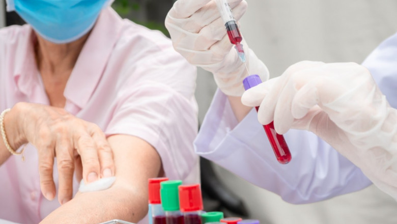 Symptoms That Should Prompt You to Take an STD Test