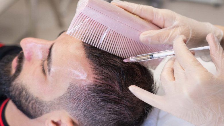 Transform Your Look with the Cheapest PRP Treatment Today