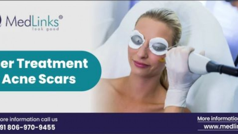Acne Scar Treatment in Delhi: Effective Solutions by Top Dermatologists at Medlinks Gurgaon