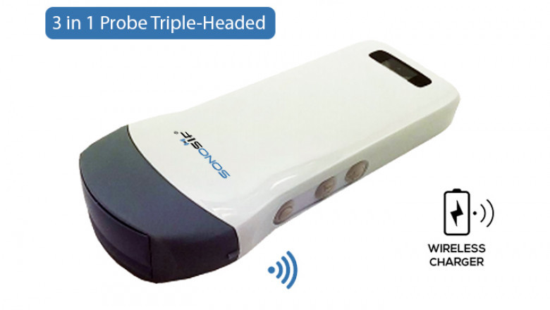 SONOSIF - Advanced Ultrasound Scanners & Medical Devices