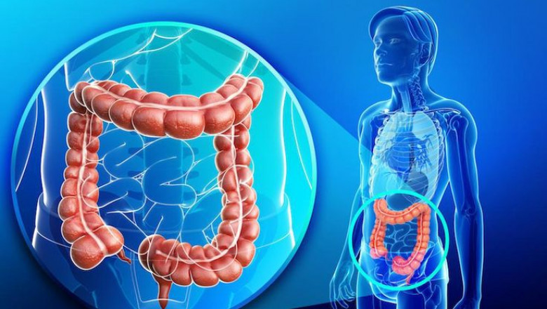 Suffering from Piles or Fistula? Consult the Best Colorectal Specialist in Bangalore