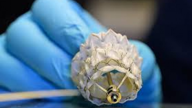 Heart Valve Devices Market Impacting Factors Driving Growth and Global Adoption Trends