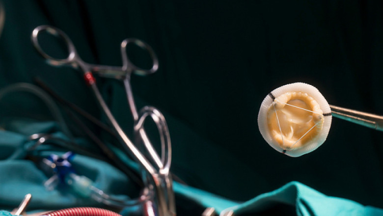 Cardiac Surgery Devices Market Struggles with Accessibility and Reimbursement in Developing Countries
