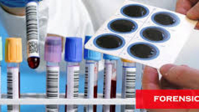 DNA Fingerprinting in India: Unveiling Identity Through Science – A Fondelco Insight