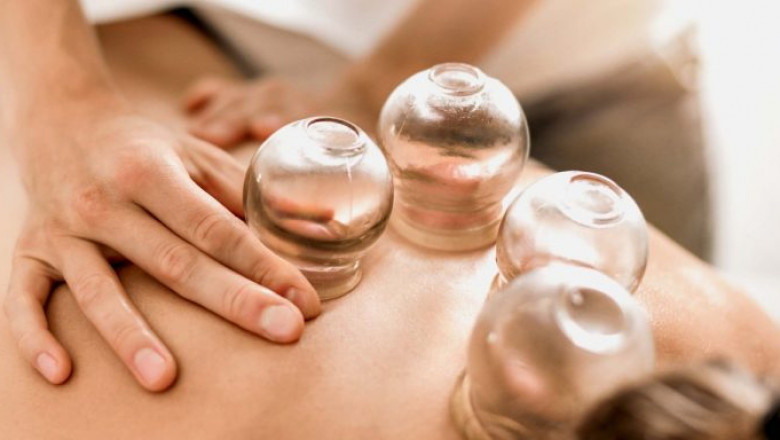 A Wellness Journey with Hijama Cupping Therapy in Dubai
